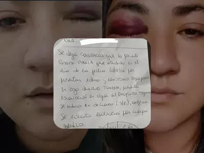 "Por si me termina de matar": una mujer de Berisso denunció a su expareja por un violento ataque