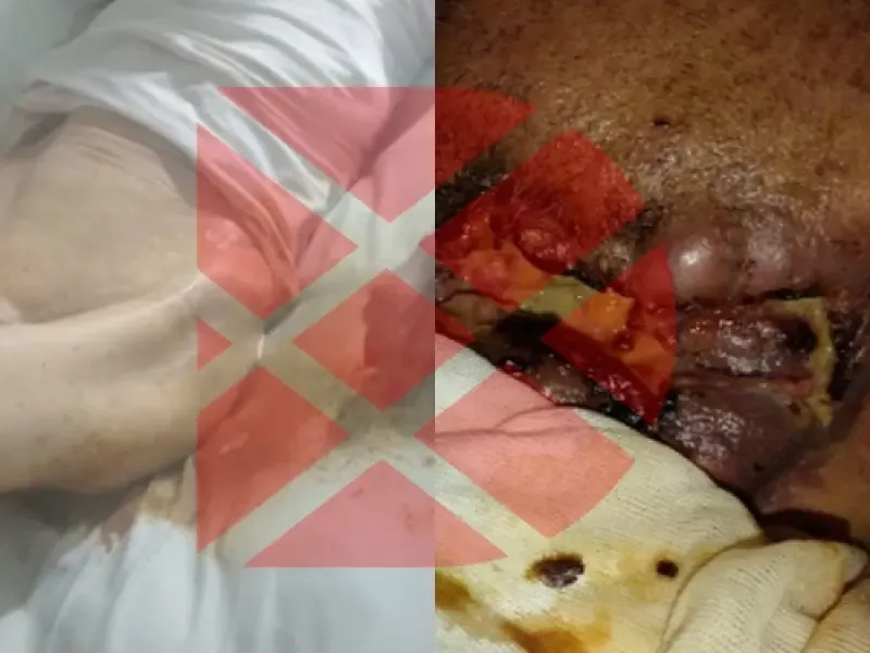 Escándalo nacional: abuelos cagados, meados y llenos de hormigas en una clínica de La Plata