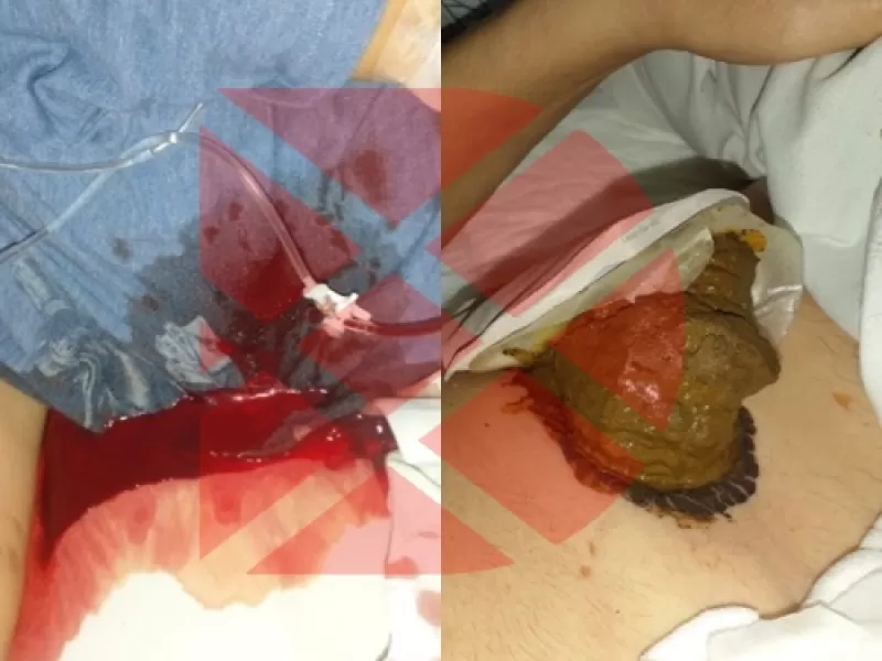 Escándalo nacional: abuelos cagados, meados y llenos de hormigas en una clínica de La Plata