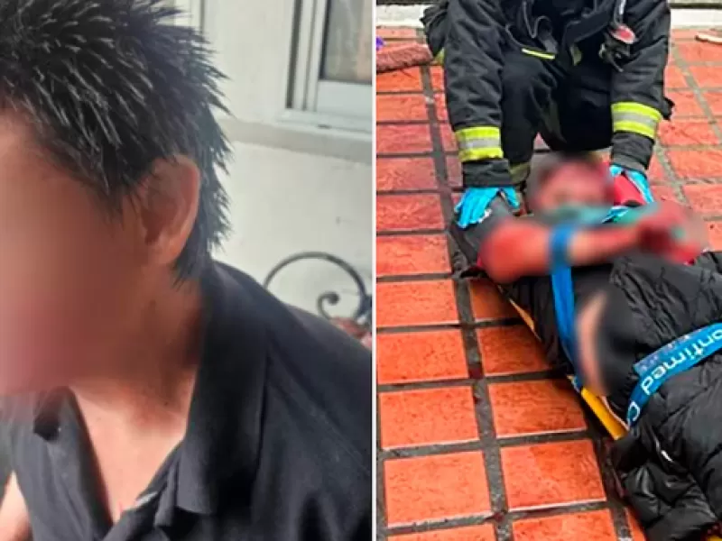 Violenta pelea entre vecinos en La Plata: se enfrentaron a cuchillazos y terminaron con el rostro desfigurado