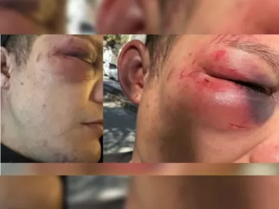 "Lo dejaron al borde de la muerte": salvaje golpiza en manada a un joven en un boliche de La Plata y las cámaras "misteriosamente" no grabaron nada